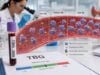 Thyroxine-Binding Globulin (TBG) Test: High, Low, Normal Range, and Thyroid Hormones Understand what a TBG blood test measures, why high or low levels alter total T4 and T3, common causes, normal ranges, and the right follow-up tests.
