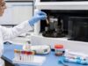 Total IgE Blood Test: High Levels, Allergy, Asthma, Parasites, and Immune Meaning Learn what total IgE measures, why levels rise with allergy, eczema, asthma, parasites, or immune disorders, and how normal, high, and very high results are evaluated.