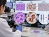 Learn how ALK testing helps classify anaplastic large cell lymphoma, what positive IHC or ALK rearrangement results mean, and when FISH or molecular confirmation is used.