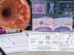 APC Mutation Test: Colon Cancer, Familial Adenomatous Polyposis, Variant Meaning, and Hereditary Risk Learn how APC mutation testing relates to familial adenomatous polyposis, colon cancer risk, germline versus tumor variants, mosaicism, and family testing.