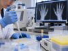 Anti-Carbamylated Protein (Anti-CarP) Test: Rheumatoid Arthritis Marker and Prognosis Understand the anti-carbamylated protein (anti-CarP) antibody test, including what it measures, positive and negative results, diagnostic limits, rheumatoid arthritis risk, and appropriate follow-up.