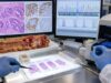 BRAF V600E testing in colon cancer helps guide prognosis, targeted therapy, and MLH1-deficient Lynch syndrome workup. Learn what positive and negative results mean.