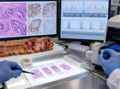 BRAF V600E testing in colon cancer helps guide prognosis, targeted therapy, and MLH1-deficient Lynch syndrome workup. Learn what positive and negative results mean.
