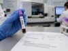 Learn what a CRP blood test measures, normal ranges and units, common causes of high levels, standard versus hs-CRP, and how trends guide inflammation care.