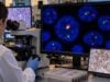 Learn how CCND1/IGH FISH detects t(11;14) in mantle cell lymphoma, what positive and negative results mean, and how cyclin D1 and SOX11 support diagnosis.