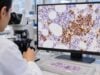 Understand what a CD138 test shows in bone marrow, what positive plasma-cell staining means, and how CD138 helps assess multiple myeloma and related disorders.