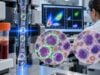 Learn what a CD33 test means in AML, how myeloid blast positivity is interpreted, and how CD33 expression can affect leukemia diagnosis, targeted treatment, and MRD follow-up.