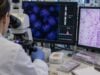 Understand CDK4 amplification testing in liposarcoma, including copy-number gain, MDM2 co-amplification, FISH and NGS methods, result meaning, diagnosis, and treatment relevance.