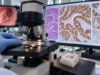 CLDN18.2 testing uses gastric cancer tissue to measure claudin 18.2 expression. Learn the ≥75% positivity threshold, IHC scoring, treatment meaning, and key limitations.