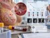 Learn what the CA 15-3 blood test measures, common reference ranges, its role in metastatic breast cancer monitoring, recurrence limits, and benign causes of high results.