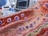 Chemokine Panel Test: Immune Signaling, Inflammation, and Cell Migration Markers Understand what a chemokine panel measures, why immune-signaling and cell-migration markers rise or fall, and how specialists interpret patterns and limitations.