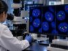 Understand CLL FISH results for del(17p), del(11q), trisomy 12, and del(13q), including what they mean for TP53 risk, prognosis, repeat testing, and treatment planning.