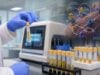 Understand what a Complement Factor B test measures, how antigen differs from Bb activation fragments, and how results relate to AH50, deficiency, kidney disease, and treatment.