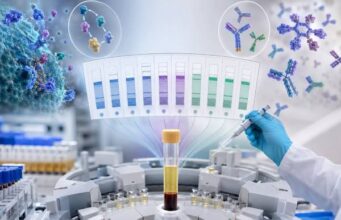 Complement and Immunoglobulin Blood Test Panel: C3, C4, CH50, IgG, IgA, IgM, and Immune Function Understand what a C3, C4, CH50, IgG, IgA, and IgM panel measures, how common result patterns are interpreted, and which follow-up tests assess complement and antibody function.