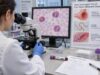 Eosinophil Count Test: EGPA, Allergy, Parasites, and High Eosinophils Understand eosinophil count ranges, common causes of high eosinophils, parasite and allergy clues, EGPA warning signs, and the follow-up tests that may be needed.