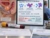 Learn how the free PSA test and percent free PSA help refine prostate cancer risk, what common percentage ranges mean, what affects results, and when follow-up is needed.