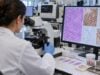 Understand Gastrointestinal Stromal Tumor (GIST) Biomarker Panel KIT, PDGFRA, DOG1, and Tumor Diagnosis: what the test measures, how results are interpreted, treatment implications, limitations, and practical next steps.