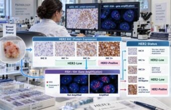 HER2 Breast Cancer Test: IHC, FISH, HER2 Score, Amplification, and HER2-Low Status Understand HER2 breast cancer testing, including IHC scores, FISH amplification, positive and negative results, HER2-low, HER2-ultralow, and treatment meaning.