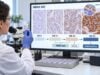 HER2 IHC Test for Breast Cancer: Protein Expression Score, HER2-Low, and Result Meaning Learn how HER2 IHC scores 0, 1+, 2+, and 3+ are interpreted, what HER2-low and ultralow mean, when FISH is needed, and how results guide breast cancer therapy.