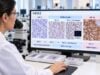 HER2-Low Breast Cancer Test: IHC Score, HER2 Expression, and Tumor Classification Learn how HER2-low breast cancer is identified by IHC 1+ or IHC 2+/ISH-negative results, how scores are interpreted, and why HER2 expression can affect treatment.