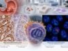 Understand HER2 Test for Gastric Cancer HER2 Expression, IHC/FISH Status, and Amplification: what the test measures, how results are interpreted, treatment implications, limitations, and practical next steps.
