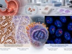 Understand HER2 Test for Gastric Cancer HER2 Expression, IHC/FISH Status, and Amplification: what the test measures, how results are interpreted, treatment implications, limitations, and practical next steps.