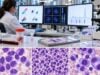 Learn how hematologic cancer biomarker panels use flow cytometry, IHC, FISH, PCR, NGS, and protein studies to diagnose and classify leukemia, lymphoma, and myeloma.