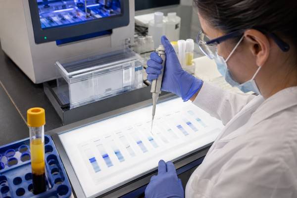 Understand serum immunofixation results, monoclonal protein types, IgG, IgA, IgM, kappa and lambda bands, plasma-cell disorders, limitations, and next steps.