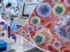 Learn how serum interferon-gamma tests, IFN-γ release assays, and anti-IFN-γ antibody tests differ, and what high, low, positive, or indeterminate results may mean.
