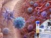 Learn what an IL-23 test measures, how the Th17 pathway affects autoimmune inflammation, why high or low results are limited, and how related diseases are evaluated.
