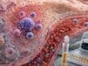 Understand what an IL-6 test measures, why levels rise in infection and inflammation, how timing and treatment affect results, and which follow-up tests add clinical meaning.