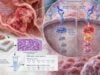 Understand KRAS Test for Colon Cancer Mutation Status, Anti-EGFR Resistance Marker, and Meaning: what the test measures, how results are interpreted, treatment implications, limitations, and practical next steps.