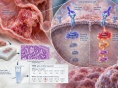 Understand KRAS Test for Colon Cancer Mutation Status, Anti-EGFR Resistance Marker, and Meaning: what the test measures, how results are interpreted, treatment implications, limitations, and practical next steps.