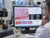 Learn what a high LDH blood test means, how cancer burden and cell damage can raise LDH, common non-cancer causes, normal ranges, and how LDH affects prognosis.