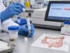 Learn what a high fecal lactoferrin test means, how it detects gut neutrophil inflammation, and how clinicians distinguish IBD, infection, and noninflammatory bowel symptoms.