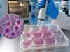 Learn how lymphocyte proliferation tests measure T-cell division, why mitogen and antigen responses differ, what low results mean, and how specimen handling affects accuracy.