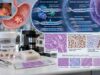 MSI Test for Gastric Cancer: Microsatellite Instability, Mismatch Repair, and Molecular Subtype Understand MSI testing in gastric cancer, including MSI-H, dMMR, MSS, molecular subtype, immunotherapy relevance, and when a result may prompt Lynch syndrome evaluation.