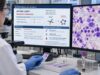 Understand MYD88 L265P testing in Waldenström macroglobulinemia and lymphoplasmacytic lymphoma, including positive and negative results, assay sensitivity, and CXCR4 context.