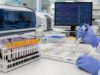 Learn how a macrophage activation syndrome blood test panel uses ferritin, blood counts, fibrinogen, liver tests, IL-18, and cytokine markers to detect dangerous hyperinflammation.