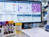 Understand the multiple myeloma test panel, including M protein, SPEP, immunofixation, free light chains, marrow testing, FISH, CRAB criteria, and staging.