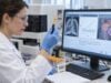 Learn what the NSE blood test measures, why neuron-specific enolase rises in small cell lung cancer and neuroendocrine tumors, and how results are monitored.