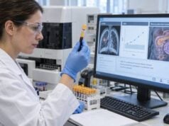 Neuron-Specific Enolase (NSE) Blood Test: Neuroendocrine Tumors, Small Cell Lung Cancer, and High Levels Learn what the NSE blood test measures, why neuron-specific enolase rises in small cell lung cancer and neuroendocrine tumors, and how results are monitored.