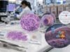 Understand PDGFRA mutation testing in GIST, including exon 12, 14, and 18 variants, D842V meaning, imatinib resistance, avapritinib, and result interpretation.