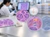 Understand PIK3CA mutation testing in breast cancer and solid tumors, including PI3K pathway biology, hotspot variants, liquid biopsy, and targeted treatment meaning.