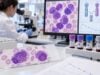 Understand PML-RARA fusion testing in acute promyelocytic leukemia, including urgent diagnosis, ATRA/ATO treatment, RT-PCR methods, molecular remission, and MRD monitoring.