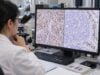 Learn how SMARCB1/INI1 loss testing is interpreted in rhabdoid tumors and sarcomas, what complete nuclear loss means, which tumors can share the pattern, when molecular or germline testing is needed, and how results may affect treatment.