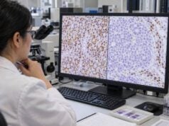 SMARCB1/INI1 Loss Test: Rhabdoid Tumor, Sarcoma, IHC Loss, and Interpretation Learn how SMARCB1/INI1 loss testing is interpreted in rhabdoid tumors and sarcomas, what complete nuclear loss means, which tumors can share the pattern, when molecular or germline testing is needed, and how results may affect treatment.