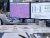Learn how SS18-SSX fusion testing confirms synovial sarcoma, how RNA NGS, FISH, RT-PCR, and fusion-specific IHC differ, what positive or negative results mean, and how the diagnosis affects modern treatment.