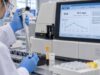 Learn what a serum amyloid A test measures, why SAA rises in acute inflammation, how it tracks disease activity, and when persistent elevation raises AA amyloidosis concern.