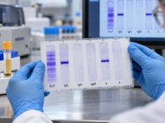 Serum Immunofixation Test: Monoclonal Protein Type, Myeloma, and Plasma Cell Disorders Understand serum immunofixation results, including monoclonal protein type, IgG/IgA/IgM and kappa/lambda patterns, myeloma testing, MGUS, and follow-up.